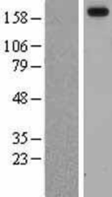 Western Blot: Laminin alpha 3 Overexpression Lysate (Adult Normal) [NBL1-12428] Left-Empty vector transfected control cell lysate (HEK293 cell lysate); Right -Over-expression Lysate for Laminin alpha 3.