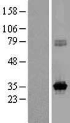 Western Blot: KCNRG Overexpression Lysate (Adult Normal) [NBL1-12202] Left-Empty vector transfected control cell lysate (HEK293 cell lysate); Right -Over-expression Lysate for KCNRG.