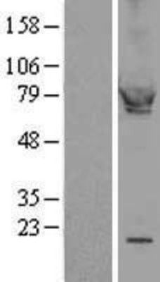 Western Blot: cGK1/PRKG1 Overexpression Lysate (Adult Normal) [NBL1-14782] Left-Empty vector transfected control cell lysate (HEK293 cell lysate); Right -Over-expression Lysate for cGK1/PRKG1.