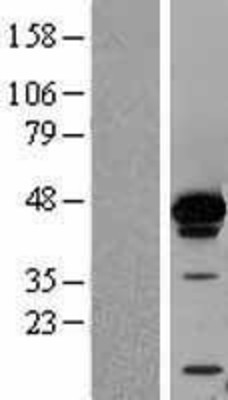 Western Blot: AUF1 Overexpression Lysate (Adult Normal) [NBL1-11641] Left-Empty vector transfected control cell lysate (HEK293 cell lysate); Right -Over-expression Lysate for AUF1.