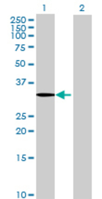 Lane 1: SDS transfected lysate (36.19 KDa) Lane 2: Non-transfected lysate.