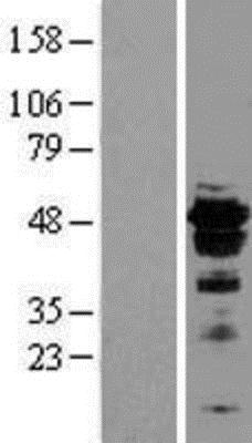Western Blot: FOXA2 Overexpression Lysate (Adult Normal) [NBL1-10799] - Left - Empty vector transfected control cell lysate (HEK293 cell lysate); Right - Over-expression Lysate for FOXA2.