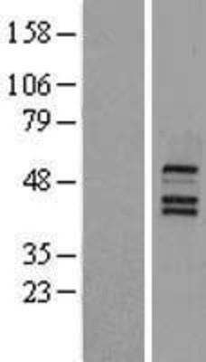 Western Blot: FXR Overexpression Lysate (Adult Normal) [NBL1-13769] Left-Empty vector transfected control cell lysate (HEK293 cell lysate); Right -Over-expression Lysate for FXR.