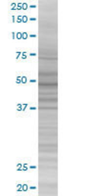 CACNB4 transfected lysate.
