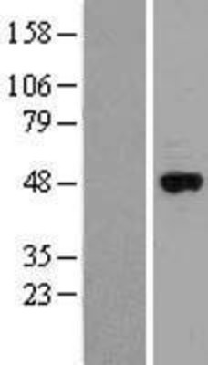 Western Blot: Cytochrome p450 2J2 Overexpression Lysate (Adult Normal) [NBL1-09688] Left-Empty vector transfected control cell lysate (HEK293 cell lysate); Right -Over-expression Lysate for Cytochrome p450 2J2.