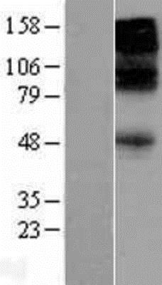 Western Blot: GABA A Receptor beta 3 Overexpression Lysate (Adult Normal) [NBL1-10922] - Left - Empty vector transfected control cell lysate (HEK293 cell lysate); Right - Over-expression Lysate for GABA A Receptor beta 3.