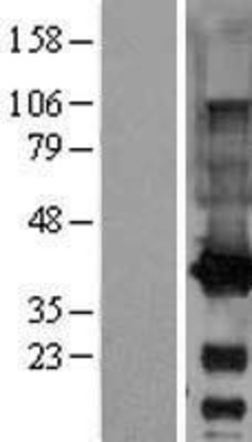 Western Blot: GALE Overexpression Lysate (Adult Normal) [NBL1-10946] Left-Empty vector transfected control cell lysate (HEK293 cell lysate); Right -Over-expression Lysate for GALE.