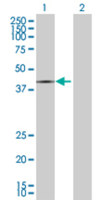 Lane 1: FCGR3A transfected lysate (32.6 KDa) Lane 2: Non-transfected lysate.