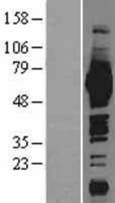 Western Blot: ME1 Overexpression Lysate (Adult Normal) [NBL1-12973] Left-Empty vector transfected control cell lysate (HEK293 cell lysate); Right -Over-expression Lysate for ME1.