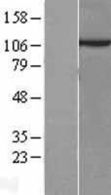 Western Blot: Sec8 Overexpression Lysate (Adult Normal) [NBL1-10379] Left-Empty vector transfected control cell lysate (HEK293 cell lysate); Right -Over-expression Lysate for Sec8.