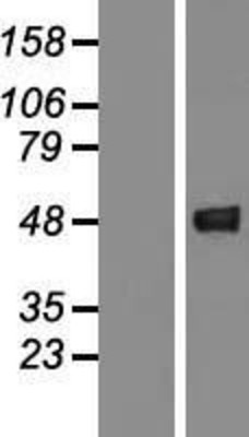 Western Blot: GCAT Overexpression Lysate (Adult Normal) [NBL1-11001] Left-Empty vector transfected control cell lysate (HEK293 cell lysate); Right -Over-expression Lysate for GCAT.