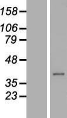 Western Blot: C21orf91 Overexpression Lysate (Adult Normal) [NBL1-08391] Left-Empty vector transfected control cell lysate (HEK293 cell lysate); Right -Over-expression Lysate for C21orf91.