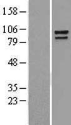 Western Blot: Catenin alpha 1 Overexpression Lysate (Adult Normal) [NBL1-09575] Left-Empty vector transfected control cell lysate (HEK293 cell lysate); Right -Over-expression Lysate for Catenin alpha 1.