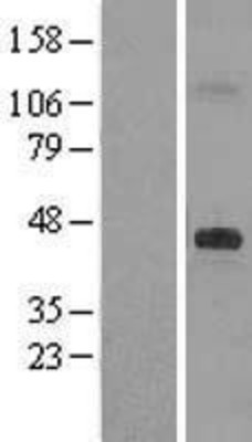 Western Blot: DHCR7 Overexpression Lysate (Adult Normal) [NBL1-09858] Left-Empty vector transfected control cell lysate (HEK293 cell lysate); Right -Over-expression Lysate for DHCR7.