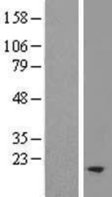 Western Blot: TM2D2 Overexpression Lysate (Adult Normal) [NBL1-16960] Left-Empty vector transfected control cell lysate (HEK293 cell lysate); Right -Over-expression Lysate for TM2D2.