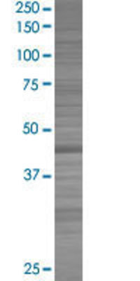 PHKG2 transfected lysate.