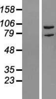 Western Blot: RIPK5 Overexpression Lysate (Adult Normal) [NBL1-15381] Left-Empty vector transfected control cell lysate (HEK293 cell lysate); Right -Over-expression Lysate for RIPK5.