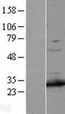 Western Blot: PSMA7 Overexpression Lysate (Adult Normal) [NBL1-14875] Left-Empty vector transfected control cell lysate (HEK293 cell lysate); Right -Over-expression Lysate for PSMA7.