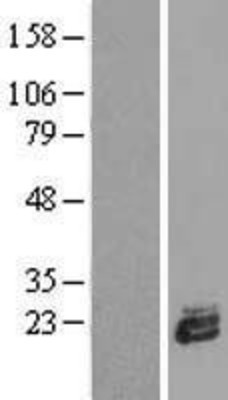 Western Blot: Cyclophilin B Overexpression Lysate (Adult Normal) [NBL1-14646] Left-Empty vector transfected control cell lysate (HEK293 cell lysate); Right -Over-expression Lysate for Cyclophilin B.