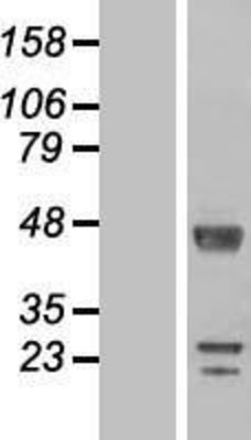 Western Blot: DKFZp566F084 Overexpression Lysate (Adult Normal) [NBL1-15485] Left-Empty vector transfected control cell lysate (HEK293 cell lysate); Right -Over-expression Lysate for DKFZp566F084.
