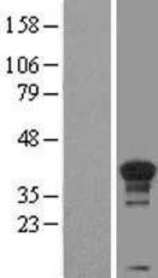 Western Blot: Cyclin H Overexpression Lysate (Adult Normal) [NBL1-08883] Left-Empty vector transfected control cell lysate (HEK293 cell lysate); Right -Over-expression Lysate for Cyclin H.