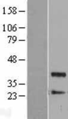 Western Blot: Protein Phosphatase 1 beta Overexpression Lysate (Adult Normal) [NBL1-14671] Left-Empty vector transfected control cell lysate (HEK293 cell lysate); Right -Over-expression Lysate for Protein Phosphatase 1 beta.