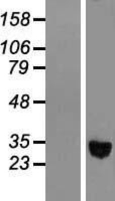 Western Blot: alcohol dehydrogenase 1C Overexpression Lysate (Adult Normal) [NBL1-07336] Left-Empty vector transfected control cell lysate (HEK293 cell lysate); Right -Over-expression Lysate for alcohol dehydrogenase 1C.
