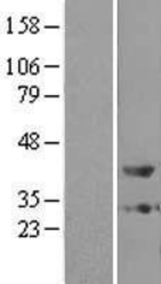 Western Blot: ZADH1 Overexpression Lysate (Adult Normal) [NBL1-14942] Left-Empty vector transfected control cell lysate (HEK293 cell lysate); Right -Over-expression Lysate for ZADH1.