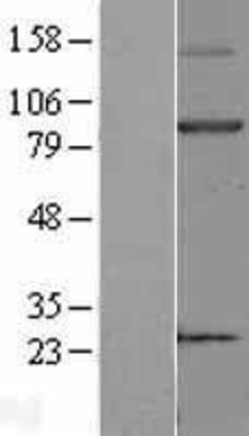Western Blot: Blood Group Kell Antigen Overexpression Lysate (Adult Normal) [NBL1-12227] Left-Empty vector transfected control cell lysate (HEK293 cell lysate); Right -Over-expression Lysate for Blood Group Kell Antigen.