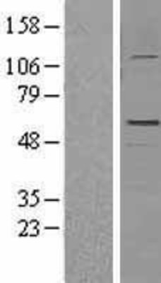 Western Blot: GFAP Overexpression Lysate (Adult Normal) [NBL1-11043] Left-Empty vector transfected control cell lysate (HEK293 cell lysate); Right -Over-expression Lysate for GFAP.
