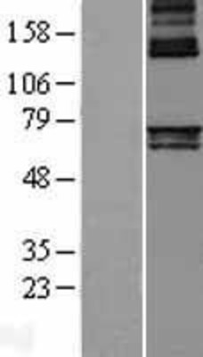 Western Blot: Alas1 Overexpression Lysate (Adult Normal) [NBL1-07447] Left-Empty vector transfected control cell lysate (HEK293 cell lysate); Right -Over-expression Lysate for Alas1.