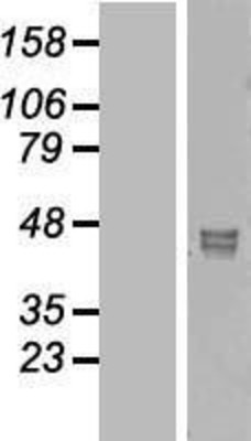 Western Blot: NANS Overexpression Lysate (Adult Normal) [NBL1-13467] Left-Empty vector transfected control cell lysate (HEK293 cell lysate); Right -Over-expression Lysate for NANS.