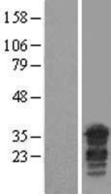 Western Blot: PPHLN1 Overexpression Lysate (Adult Normal) [NBL1-14644] Left-Empty vector transfected control cell lysate (HEK293 cell lysate); Right -Over-expression Lysate for PPHLN1.