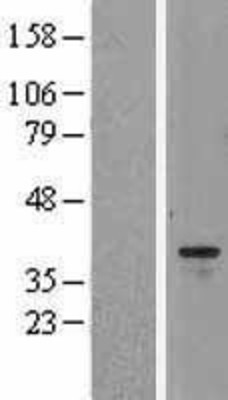 Western Blot: Aurora B Overexpression Lysate (Adult Normal) [NBL1-07860] Left-Empty vector transfected control cell lysate (HEK293 cell lysate); Right -Over-expression Lysate for Aurora B.