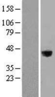 Western Blot: LRG1 Overexpression Lysate (Adult Normal) [NBL1-12665] Left-Empty vector transfected control cell lysate (HEK293 cell lysate); Right -Over-expression Lysate for LRG1.
