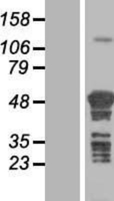 Western Blot: TSPYL4 Overexpression Lysate (Adult Normal) [NBL1-17388] Left-Empty vector transfected control cell lysate (HEK293 cell lysate); Right -Over-expression Lysate for TSPYL4.