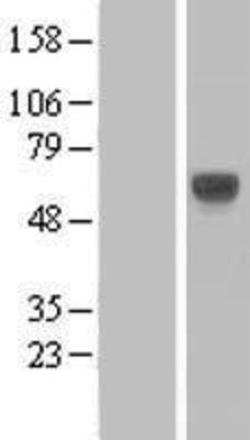 Western Blot: LILRA3 Overexpression Lysate (Adult Normal) [NBL1-12525] Left-Empty vector transfected control cell lysate (HEK293 cell lysate); Right -Over-expression Lysate for LILRA3.