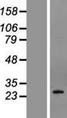 Western Blot: Podoplanin Overexpression Lysate (Adult Normal) [NBL1-14262] Left-Empty vector transfected control cell lysate (HEK293 cell lysate); Right -Over-expression Lysate for Podoplanin.