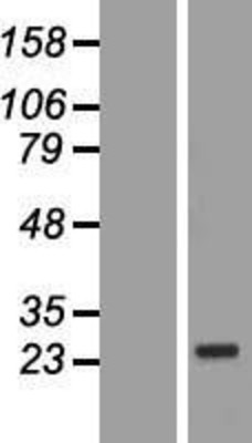 Western Blot: COP Overexpression Lysate (Adult Normal) [NBP2-11021] Left-Empty vector transfected control cell lysate (HEK293 cell lysate); Right -Over-expression Lysate for COP.