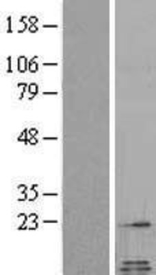 Western Blot: Galanin Overexpression Lysate (Adult Normal) [NBL1-10942] Left-Empty vector transfected control cell lysate (HEK293 cell lysate); Right -Over-expression Lysate for Galanin.