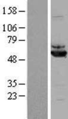 Western Blot: ALDH7A1 Overexpression Lysate (Adult Normal) [NBL1-07458] Left-Empty vector transfected control cell lysate (HEK293 cell lysate); Right -Over-expression Lysate for ALDH7A1.