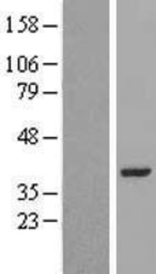 Western Blot: LRRC39 Overexpression Lysate (Adult Normal) [NBL1-12691] Left-Empty vector transfected control cell lysate (HEK293 cell lysate); Right -Over-expression Lysate for LRRC39.