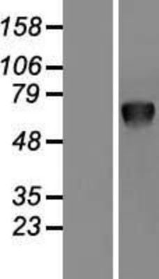 Western Blot: PSAP Overexpression Lysate (Adult Normal) [NBL1-14855] Left-Empty vector transfected control cell lysate (HEK293 cell lysate); Right -Over-expression Lysate for PSAP.