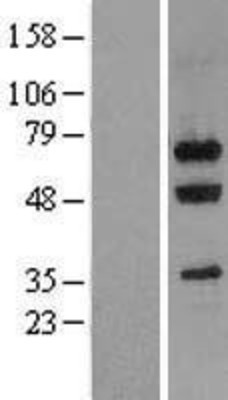 Western Blot: Nucleostemin Overexpression Lysate (Adult Normal) [NBL1-11183] Left-Empty vector transfected control cell lysate (HEK293 cell lysate); Right -Over-expression Lysate for Nucleostemin.
