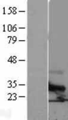 Western Blot: Tetraspanin-6 Overexpression Lysate (Adult Normal) [NBL1-17380] Left-Empty vector transfected control cell lysate (HEK293 cell lysate); Right -Over-expression Lysate for Tetraspanin-6.
