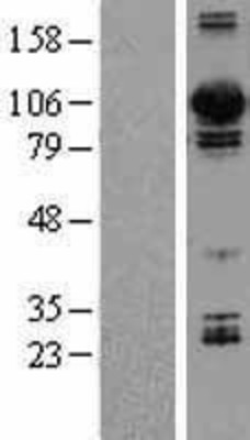 Western Blot: Dynamin 3 Overexpression Lysate (Adult Normal) [NBL1-09969] Left-Empty vector transfected control cell lysate (HEK293 cell lysate); Right -Over-expression Lysate for Dynamin 3.