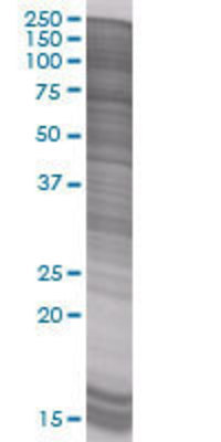 GBP5 transfected lysate.