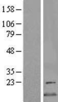 Western Blot: CDK2AP2 Overexpression Lysate (Adult Normal) [NBL1-09038] Left-Empty vector transfected control cell lysate (HEK293 cell lysate); Right -Over-expression Lysate for CDK2AP2.