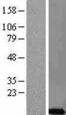 Western Blot: CREM Overexpression Lysate (Adult Normal) [NBL1-09471] Left-Empty vector transfected control cell lysate (HEK293 cell lysate); Right -Over-expression Lysate for CREM.