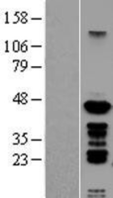Western Blot: PSMC6 Overexpression Lysate (Adult Normal) [NBL1-14893] Left-Empty vector transfected control cell lysate (HEK293 cell lysate); Right -Over-expression Lysate for PSMC6.